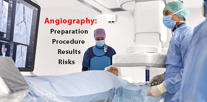 angiography-angiogram-preparation-procedure-results-and-risks