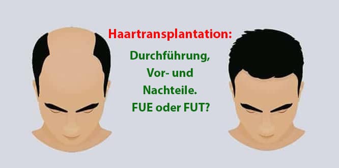 Haartransplantation Durchfuhrung Vor Und Nachteile Fue Oder Fut