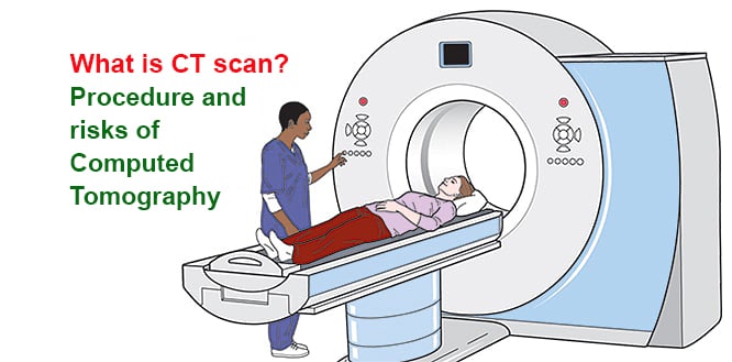 High Blood Pressure Ct Scan Head Ct Scan Machine - kulturaupice