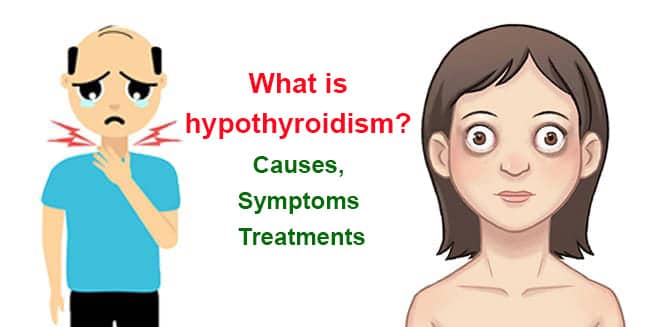 What is hypothyroidism? Causes, symptoms and treatments